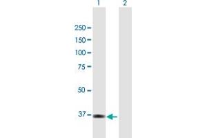 Western Blot analysis of TNK2 expression in transfected 293T cell line by TNK2 MaxPab polyclonal antibody. (TNK2 抗体  (AA 1-352))