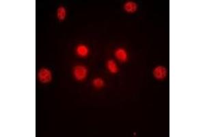 Immunofluorescent analysis of c-Jun staining in HeLa cells.