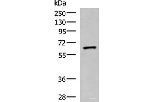 Western blot analysis of Human placenta tissue lysate using PDIA5 Polyclonal Antibody at dilution of 1:1000 (PDIA5 抗体)