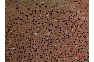 Immunohistochemistry (IHC) analysis of paraffin-embedded Mouse Brain, antibody was diluted at 1:100. (CDH6 抗体  (Internal Region))