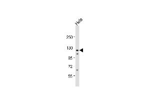 Anti-VINC Antibody (C-term) at 1:1000 dilution + Hela whole cell lysate Lysates/proteins at 20 μg per lane. (Vinculin 抗体  (C-Term))