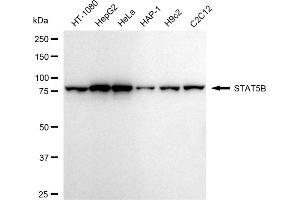 Western blotting analysis using STAT5B antibody (ABIN7800348). (Recombinant STAT5B 抗体)
