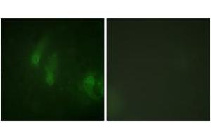 Immunofluorescence analysis of HeLa cells, using FANCA (Phospho-Ser1149) Antibody. (FANCA 抗体  (pSer1149))