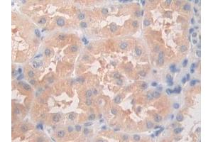 DAB staining on IHC-P; Samples: Human Kidney Tissue (ANGPTL5 抗体  (AA 141-383))