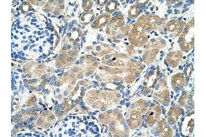 TM9SF1 antibody was used for immunohistochemistry at a concentration of 4-8 ug/ml to stain Epithelial cells of renal tubule (arrows) in Human Kidney. (TM9SF1 抗体  (Middle Region))