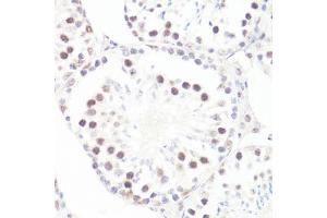 Immunohistochemistry of paraffin-embedded mouse testis using P-MYC-S62 antibody (ABIN3019544, ABIN3019545, ABIN3019546 and ABIN6225456) at dilution of 1:100 (40x lens). (c-MYC 抗体  (pSer62))