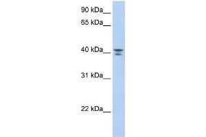 WB Suggested Anti-GNA12 Antibody Titration: 0. (GNA12 抗体  (Middle Region))