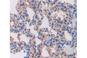 Used in DAB staining on fromalin fixed paraffin- embedded lung tissue (ABCA8 抗体  (AA 1303-1514))