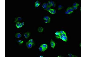 Immunofluorescent analysis of MCF-7 cells using ABIN7171103 at dilution of 1:100 and Alexa Fluor 488-congugated AffiniPure Goat Anti-Rabbit IgG(H+L) (SV2B 抗体  (AA 1-108))