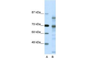 WB Suggested Anti-NCOR2 Antibody Titration:  0. (NCOR2 抗体  (N-Term))