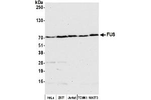 Western Blotting (WB) image for anti-Fused in Sarcoma (FUS) (AA 1-50) antibody (ABIN7454969) (FUS 抗体  (AA 1-50))