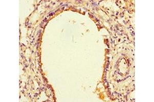 Immunohistochemistry of paraffin-embedded human lung tissue using ABIN7169807 at dilution of 1:100 (SLITRK6 抗体  (AA 621-821))
