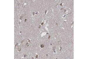 ABIN6266655 at 1/100 staining human brain tissue sections by IHC-P. (PIAS3 抗体  (N-Term))