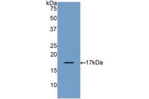 Western blot analysis of recombinant Human GRN. (Granulin 抗体  (AA 21-120))