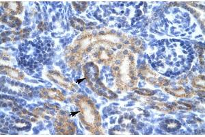 Human kidney; Rabbit Anti-OR13C9 Antibody. (OR13C9 抗体  (Middle Region))