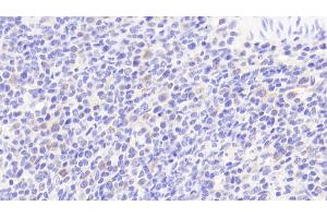 Detection of IL6 in Human Spleen Tissue using Polyclonal Antibody to Interleukin 6 (IL6) (IL-6 抗体  (AA 29-212))