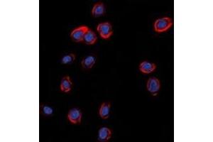 Immunofluorescent analysis of GLUR1 staining in A549 cells. (Glutamate Receptor 1 抗体  (C-Term))