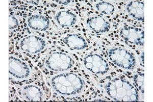 Image no. 1 for anti-Mitogen-Activated Protein Kinase Kinase 4 (MAP2K4) antibody (ABIN1499480) (MAP2K4 抗体)