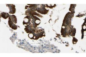 ABIN6269264 at 1/100 staining Mouse intestine tissue by IHC-P. (Crk 抗体)