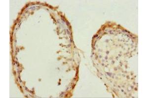 Immunohistochemistry of paraffin-embedded human testis tissue using ABIN7147293 at dilution of 1:100 (CDC7 抗体  (AA 275-574))