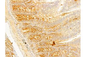 ABIN6255513 and ABIN6267630 at 1/100 staining Rat colon tissue by IHC-P. (Acetyl-CoA Carboxylase alpha 抗体  (pSer79, pSer80))