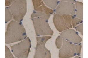 DAB staining on IHC-P; Samples: Rat Skeletal muscle Tissue (APOB 抗体  (AA 2747-2913))