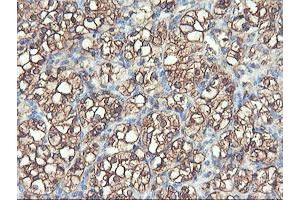 Image no. 1 for anti-phosphofructokinase, Platelet (PFKP) antibody (ABIN1500161) (PFKP 抗体)