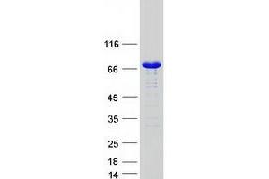 Western Blotting (WB) image for Sorting Nexin 1 (SNX1) (Transcript Variant 1) protein (Myc-DYKDDDDK Tag) (ABIN2732378)