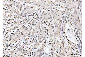 IHC analysis of RAE1 using anti-RAE1 antibody (ABIN7602428).