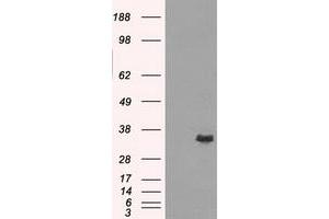Image no. 3 for anti-Aldo-Keto Reductase Family 1, Member A1 (Aldehyde Reductase) (AKR1A1) antibody (ABIN1496542) (AKR1A1 抗体)