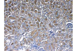 IHC analysis of CD151 using anti- CD151 antibody .