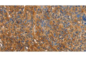 Immunohistochemistry (Paraffin-embedded Sections) (IHC (p)) image for anti-Orosomucoid 2 (ORM2) antibody (ABIN7236293)