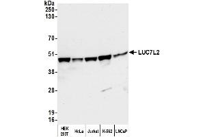 Western Blotting (WB) image for anti-LUC7-Like 2 (LUC7L2) (AA 340-390) antibody (ABIN7449664)