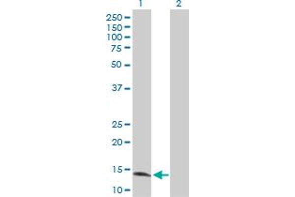Zinc Finger Protein 44 抗体  (AA 1-154)