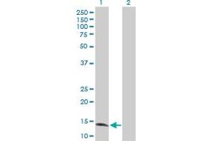 Western Blot analysis of ZNF44 expression in transfected 293T cell line by ZNF44 MaxPab polyclonal antibody. (Zinc Finger Protein 44 抗体  (AA 1-154))