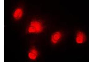 Immunofluorescent analysis of c-RAF staining in HeLa cells. (RAF1 抗体  (Center))