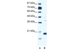 WB Suggested Anti-CACNG1 Antibody Titration:  0. (CACNG1 抗体  (N-Term))