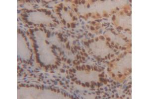 Used in DAB staining on fromalin fixed paraffin- embedded stomach tissue (HMG20B 抗体  (AA 27-213))