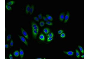 Immunofluorescent analysis of HepG2 cells using ABIN7173111 at dilution of 1:100 and Alexa Fluor 488-congugated AffiniPure Goat Anti-Rabbit IgG(H+L) (TMEM184C 抗体  (AA 107-178))