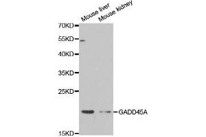 Western blot analysis of extracts of various cell lines, using GADD45A antibody. (GADD45A 抗体  (AA 1-165))