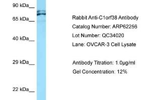 Western Blotting (WB) image for anti-Chromosome 1 Open Reading Frame 38 (C1orf38) (C-Term) antibody (ABIN2789083) (C1orf38 抗体  (C-Term))