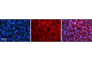 Rabbit Anti-MBD2 Antibody    Formalin Fixed Paraffin Embedded Tissue: Human Adult liver  Observed Staining: Nuclear Primary Antibody Concentration: 1:100 Secondary Antibody: Donkey anti-Rabbit-Cy2/3 Secondary Antibody Concentration: 1:200 Magnification: 20X Exposure Time: 0.