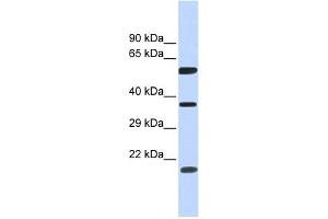 WB Suggested Anti-NT5DC1 Antibody Titration: 0. (NT5DC1 抗体  (N-Term))