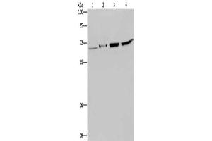 Gel: 8 % SDS-PAGE, Lysate: 40 μg, Lane 1-4: Human testis tissue, mouse liver tissue, Hela cells, 293T cells, Primary antibody: ABIN7129681(HACL1 Antibody) at dilution 1/200, Secondary antibody: Goat anti rabbit IgG at 1/8000 dilution, Exposure time: 5 minutes