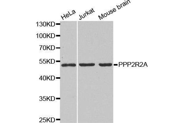 PPP2R2A 抗体  (AA 1-447)