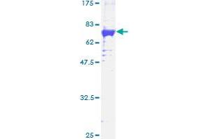 Image no. 2 for Mitogen-Activated Protein Kinase-Activated Protein Kinase 3 (MAPKAPK3) (AA 1-382) protein (GST tag) (ABIN1310326)