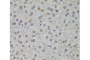Immunohistochemistry of paraffin-embedded Mouse liver using SKP2 Polyclonal Antibody at dilution of 1:100 (40x lens). (SKP2 抗体)