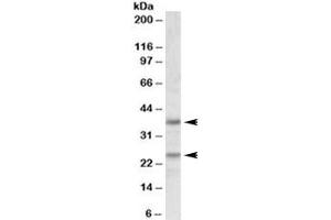 Western blot testing of human cerebellum lysate with Podoplanin antibody at 1ug/ml. (Podoplanin 抗体)
