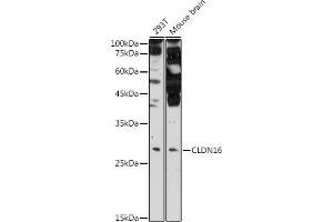 Western blot analysis of extracts of various cell lines, using CLDN16 antibody (ABIN6133646, ABIN6138679, ABIN6138680 and ABIN6225195) at 1:500 dilution. (Claudin 16 抗体  (AA 50-150))