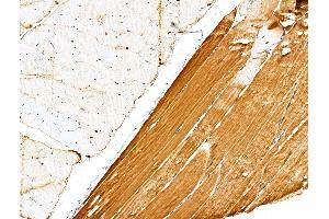 ABIN6263820 and ABIN6276785 at 1/100 staining Rat muscle tissue by IHC-P.
